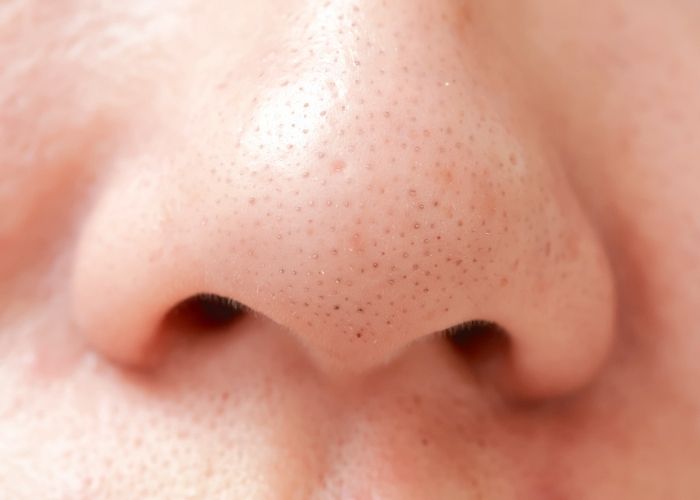 how to remove blackheads on nose healthbeautybee