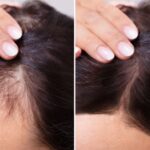 food for hair growth and thickness