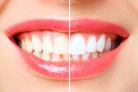 how to get white teeth healthbeautybee