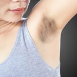 How to Get Rid of Dark Underarms healthbeautybee