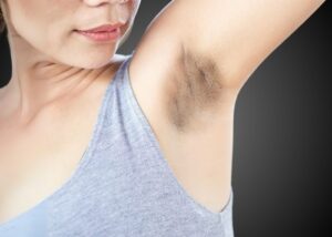 How to Get Rid of Dark Underarms healthbeautybee