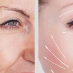 How to Prevent Aging Skin in Your 30s Naturally