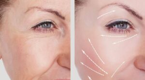 How to Prevent Aging Skin in Your 30s Naturally